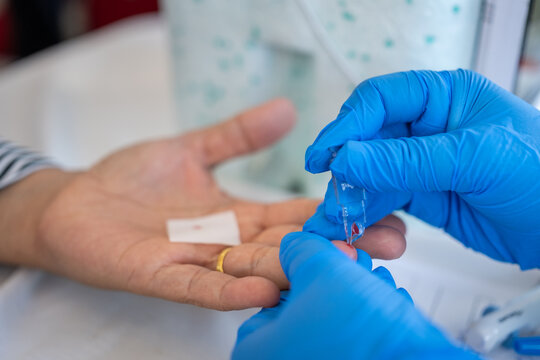 A healthcare worker wearing blue gloves collects a blood sample from a patient's fingertip using a capillary tube. Medical test, healthcare, and laboratory diagnostics concept.