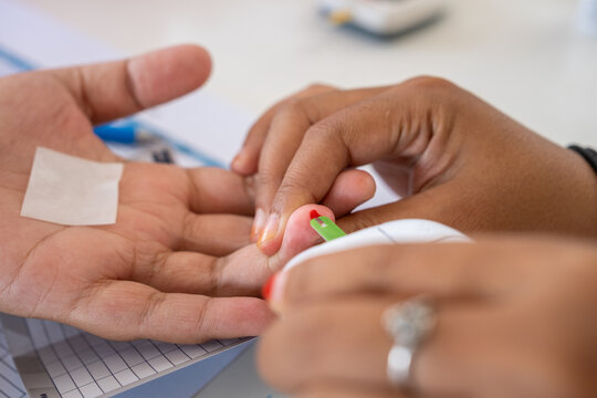 Close-up of a medical professional performing a blood sugar test using a glucometer on a patient’s fingertip. A drop of blood is collected for diabetes screening and health monitoring. - Powered by Adobe