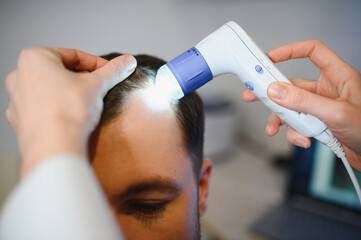 A trichologist examines the hair of a man who begins alopecia. Consultation with a dermatologist....