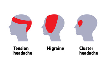 Common types of headache, migraine, tension headache and cluster headache.