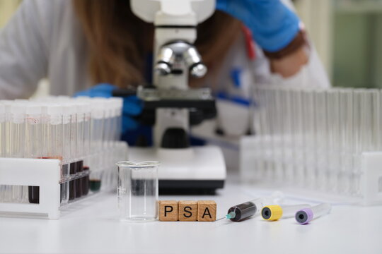 A skilled lab technician performs PSA testing by utilizing a microscope along with various test tubes and equipment - Powered by Adobe