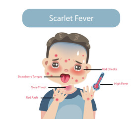 Children with Symptoms of Scarlet Fever Illustration