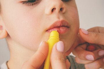 Mom applying lipstick to boy's dry lips.