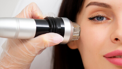 Close-up of a young girl undergoing fractional radiofrequency facelift at a medical center, skin...