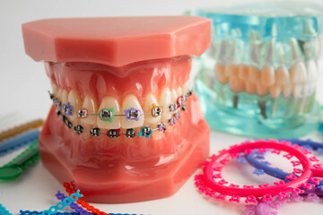 Orthodontic ligatures rings and ties, elastic rubber bands on orthodontic braces, model for dentist studying about dentistry.