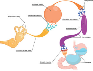 Motion sickness schematic illustration. What are the causes of motion sickness​