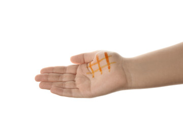 Female hand with iodine mesh on white background. Closeup