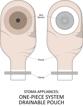 Stoma one piece