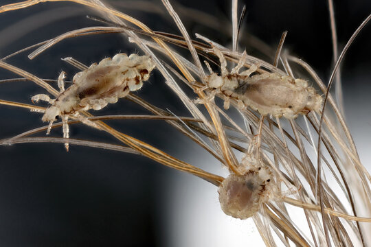 Head louse, Pediculus humanus capitis, on a human hair.