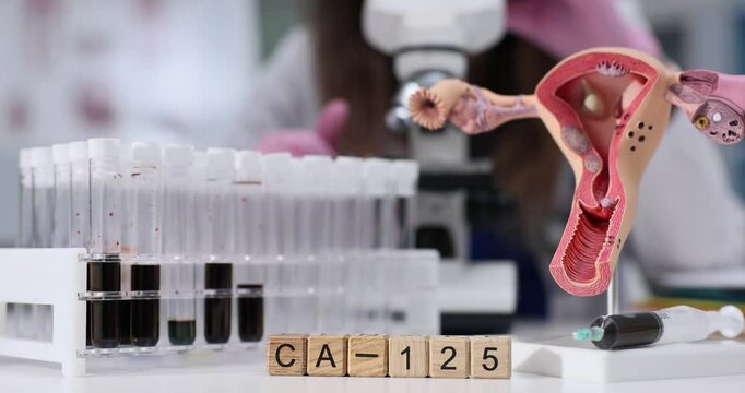 Indepth exploration of CA125 markers in gynecological studies using advanced lab equipment and techniques