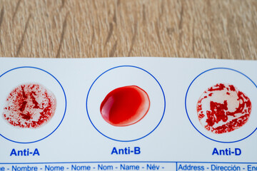 Blood typing test card with Anti-A, Anti-B, Anti-D result, diagnostics and health awareness,...