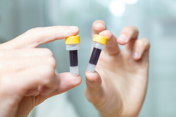 Hands holding blood collection vial and lancet, medical testing and diagnostics, Blood collection...