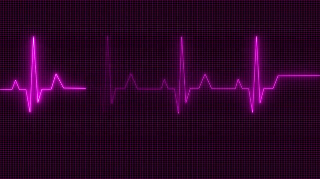 Abstract neon heartbeat signal icon animation background. This is an electrical activity of heart. This can present various types of diseases of heart. This is used as initial investigation of heart.