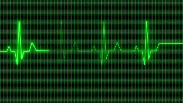 Abstract neon heartbeat signal icon animation background. This is an electrical activity of heart. This can present various types of diseases of heart. This is used as initial investigation of heart.