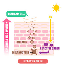 肌断面図で見せるシミのイラスト