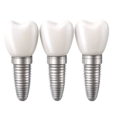 dental implants on white background.