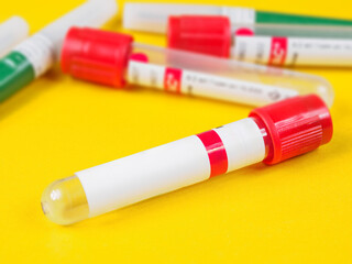 A close-up of a blood collection container, ready for medical testing. Sterile and professional.