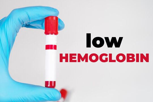 Low hemoglobin name of medical test test tube