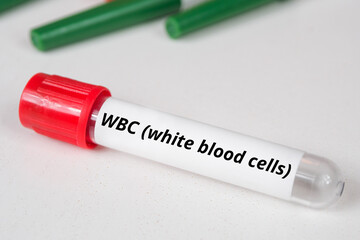 WBC (white blood cells) name of blood test