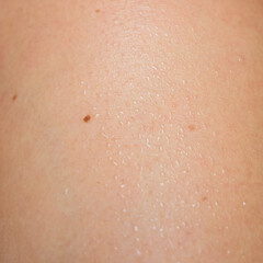 Fototapeta premium Detailed human skin with small moles and water drops, showcasing natural texture and hydration