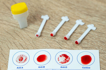 Blood typing test card with Anti-A, Anti-B, Anti-D result, diagnostics and health awareness,...