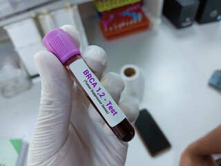 Scientist hold blood sample for BRCA1 and BRCA2 test. Two genes are called tumor suppressor genes.