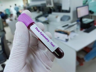 Lab Technologist holds blood sample for Flow Cytometry test with laboratory background.