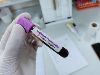 Scientist hold blood sample for Legionella Pneumophila Positive test tube. Healthcare and medical test concept.