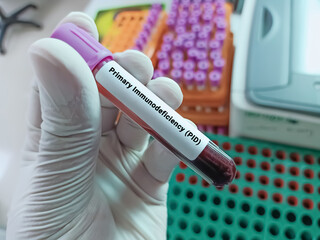 Doctor hold Blood sample for Primary Immunodeficiency (PID) test. Medical testing concept with...