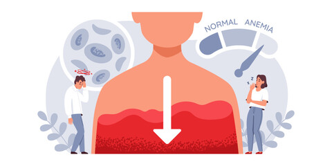 Iron Deficiency Anemia Symptoms. Characters experience symptoms of iron deficiency: fatigue, dizziness, pale skin, and shortness of breath. Vector medical flat illustration