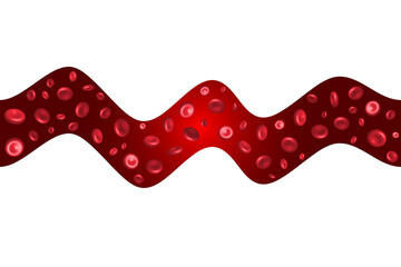 Blood flow design through a vein