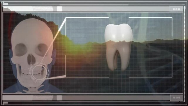 X-ray animation showing human skull and tooth against digital grid background