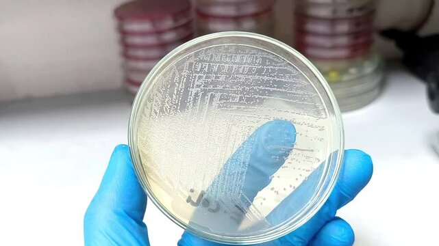 A microbiological culture Petri dish with a colonies of the pathogenic bacterium Escherichia coli (E. coli)