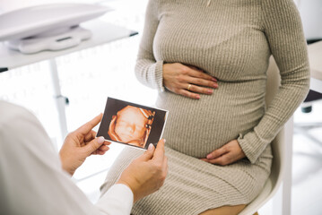 Gynecologist showing ultrasound scan to pregnant woman