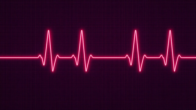 Electrocardiogram show monomorphic ventricular tachycardia (VT). Cardiac fibrillation. Heart beat. CPR. ECG. EKG. Vital sign. Life support. Medical healthcare symbol.