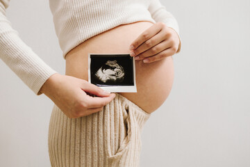 Happy expectant mom shows fetus ultrasound image after sonogram. Pregnant holds sonogram picture of unborn baby inside her big belly.