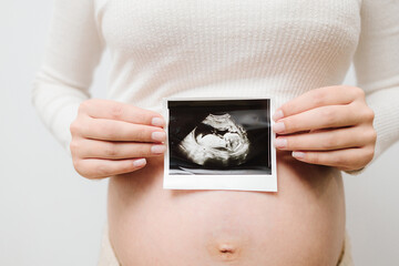 Filming precious moments of motherhood with sonogram. Pregnant woman holds an ultrasound photo of her baby on her tummy.