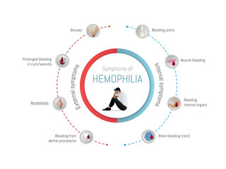 Hemophilia symptoms showing internal and external bleeding problems