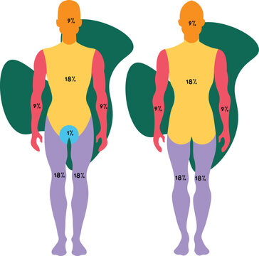 The Wallace Rule of Nines is a clinical tool used to estimate the total body surface area (TBSA) affected by burns in adult patients