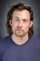 Adult male with Bell's Palsy or facial paralysis