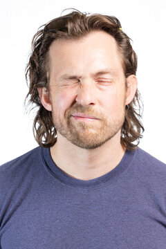 Adult male with Bell's Palsy or facial paralysis