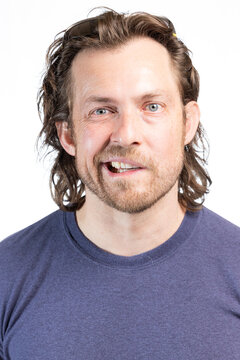Adult male with Bell's Palsy or facial paralysis