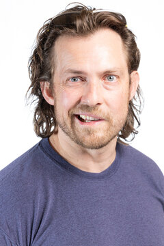 Adult male with Bell's Palsy or facial paralysis