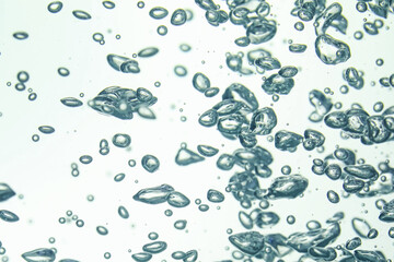 Many water bubbles on light background, closeup