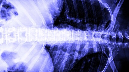 MRI human body scan, Monochrome magnetic resonance imaging of a human body parts. Layer view of CT scan with anatomical details.