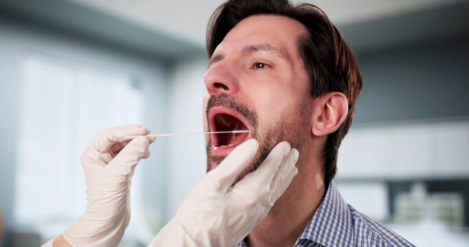 Medical professionals perform mouth swab DNA test