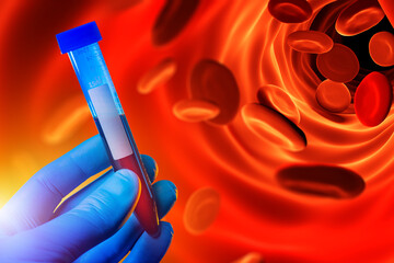 Laboratory blood tests. Erythrocytes near test tube. Human DNA test. Doctor hand with blood inside...