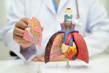 Pneumonia, lung cancer, Asian doctor holding human anatomy model for study diagnosis and treatment...