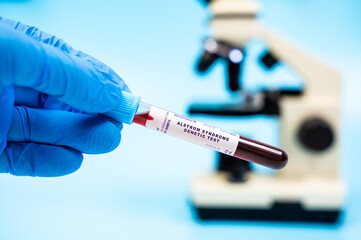 Detects mutations in the ALMS1 gene, leading to Alstrom