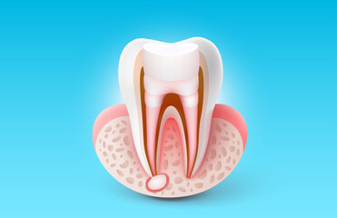 Protection of teeth, treatment of tooth root inflammation. Vector illustration